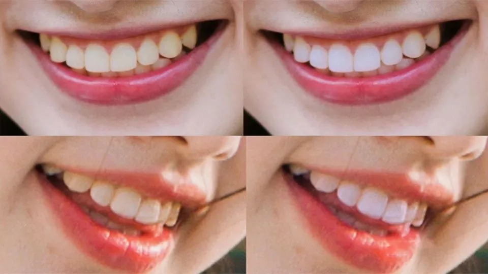 人像精修快速牙齿美白万能通用方法摄影后期调色中文教程